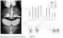Fig. 21 - METHODS FOR VECTOR-BASED TARGETING OF THE HUMAN CENTRAL THALAMUS TO GUIDE DEEP BRAIN STIMULATION AND DEVICES THEREFOR