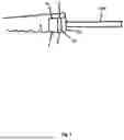 Fig. 02 - Tongue Training Appliance With Handle