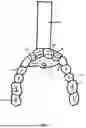 Fig. 06 - Tongue Training Appliance With Handle