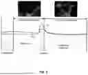 Fig. 06 - WEARABLE FERTILITY PREDICTION DEVICE