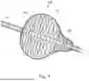 Fig. 10 - DEPLOYABLE STRUCTURES TO PROVIDE ELECTRODES ON THE SURFACE OF AN ENDOSCOPICALLY GUIDED LASER ABLATION CATHETER FOR USE IN ABLATION AND ELECTROPHYSIOLOGICAL MAPPING