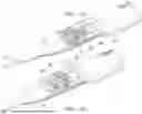 Fig. 17 - DEPLOYABLE STRUCTURES TO PROVIDE ELECTRODES ON THE SURFACE OF AN ENDOSCOPICALLY GUIDED LASER ABLATION CATHETER FOR USE IN ABLATION AND ELECTROPHYSIOLOGICAL MAPPING