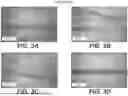 Fig. 04 - MESHED DERMAL TISSUE MATRIX PRODUCTS