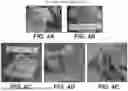 Fig. 05 - MESHED DERMAL TISSUE MATRIX PRODUCTS