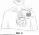 Fig. 09 - MESHED DERMAL TISSUE MATRIX PRODUCTS