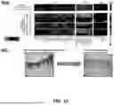 Fig. 17 - METHODS FOR TREATING HAIR LOSS DISORDERS