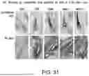 Fig. 40 - METHODS FOR TREATING HAIR LOSS DISORDERS