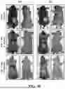 Fig. 49 - METHODS FOR TREATING HAIR LOSS DISORDERS