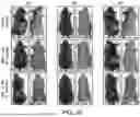 Fig. 50 - METHODS FOR TREATING HAIR LOSS DISORDERS