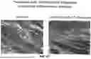 Fig. 66 - METHODS FOR TREATING HAIR LOSS DISORDERS