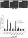 Fig. 84 - METHODS FOR TREATING HAIR LOSS DISORDERS