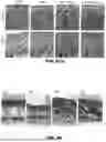 Fig. 95 - METHODS FOR TREATING HAIR LOSS DISORDERS