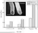 Fig. 23 - CREATING HYDROGEL FILMS USING A MULTILAYERED EXTRUSION REACTOR APPARATUS