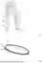 Fig. 06 - ASSEMBLY COMPRISING A CONTAINER AND A LID INTENDED TO CLOSE THE CONTAINER