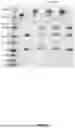 Fig. 30 - ANTI-ROR ANTIBODY CONSTRUCTS