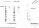 Fig. 67 - ANTI-ROR ANTIBODY CONSTRUCTS