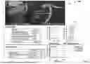 Fig. 02 - PROGRESSIVE EXPLOITATION OF MULTI-ENERGY AND PHOTON COUNTING MODALITIES