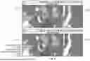 Fig. 04 - PROGRESSIVE EXPLOITATION OF MULTI-ENERGY AND PHOTON COUNTING MODALITIES