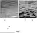 Fig. 02 - CHARACTERIZING SOFT TISSUE SUBRUPTURE DAMAGE AND INCOMPLETE TEAR DAMAGE FOR PERFORMING A PROCESS