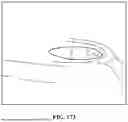 Fig. 197 - PIXEL ARRAY MEDICAL SYSTEMS, DEVICES AND METHODS