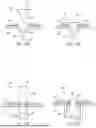 Fig. 16 - METHODS AND DEVICES FOR INTRACORPOREAL BONDING OF IMPLANTS WITH THERMAL ENERGY