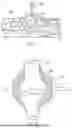 Fig. 34 - METHODS AND DEVICES FOR INTRACORPOREAL BONDING OF IMPLANTS WITH THERMAL ENERGY