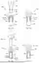 Fig. 48 - METHODS AND DEVICES FOR INTRACORPOREAL BONDING OF IMPLANTS WITH THERMAL ENERGY