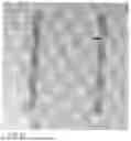 Fig. 55 - METHODS AND DEVICES FOR INTRACORPOREAL BONDING OF IMPLANTS WITH THERMAL ENERGY