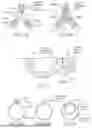 Fig. 65 - METHODS AND DEVICES FOR INTRACORPOREAL BONDING OF IMPLANTS WITH THERMAL ENERGY