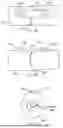 Fig. 70 - METHODS AND DEVICES FOR INTRACORPOREAL BONDING OF IMPLANTS WITH THERMAL ENERGY