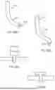 Fig. 92 - METHODS AND DEVICES FOR INTRACORPOREAL BONDING OF IMPLANTS WITH THERMAL ENERGY