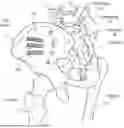 Fig. 01 - FENESTRATED IMPLANT