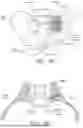 Fig. 29 - FENESTRATED IMPLANT
