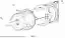 Fig. 43 - SYSTEMS AND METHODS FOR FORCE REDUCTION IN DELIVERY SYSTEMS
