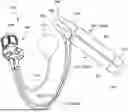 Fig. 01 - PUMP ASSEMBLY FOR A PENILE PROSTHESIS