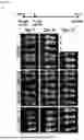 Fig. 07 - CD19-SPECIFIC CHIMERIC ANTIGEN RECEPTOR T-CELL THERAPY