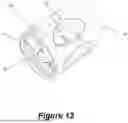Fig. 06 - TRACHEOSTOMY GUARD