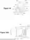 Fig. 08 - TRACHEOSTOMY GUARD