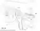 Fig. 02 - SEAL-FORMING STRUCTURE, POSITIONING AND STABILIZING STRUCTURE AND DIFFUSER VENT FOR PATIENT INTERFACE