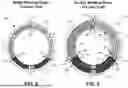 Fig. 04 - INTRAVASCULAR BLOOD PUMP HAVING MULTILAYER CORELESS COILS