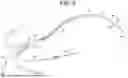 Fig. 07 - Systems and methods for intravascular catheter positioning and/or nerve stimulation