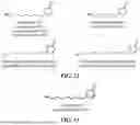 Fig. 08 - METHODS FOR PREPARING BUTENOLIDES