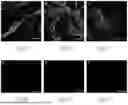 Fig. 07 - METHODS OF RECELLULARIZING A TISSUE OR ORGAN FOR IMPROVED TRANSPLANTABILITY