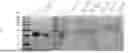 Fig. 02 - Aptamer for DKK1 and Use Thereof