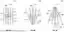 Fig. 05 - SYSTEM AND METHOD FOR UNTETHERED MULTIFINGER IMAGING OF A WELLBORE INNER WALL