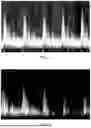 Fig. 02 - GENERATION METHOD AND DEVICE FOR BLOOD FLOW SPECTRUM ENVELOPE, AND READABLE STORAGE MEDIUIM