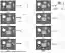 Fig. 01 - Methods, Processes, and Systems for Soft and Glandular Tissue Vascularity Assessment