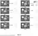 Fig. 04 - Methods, Processes, and Systems for Soft and Glandular Tissue Vascularity Assessment
