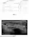 Fig. 06 - Methods, Processes, and Systems for Soft and Glandular Tissue Vascularity Assessment