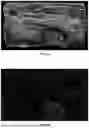 Fig. 07 - Methods, Processes, and Systems for Soft and Glandular Tissue Vascularity Assessment